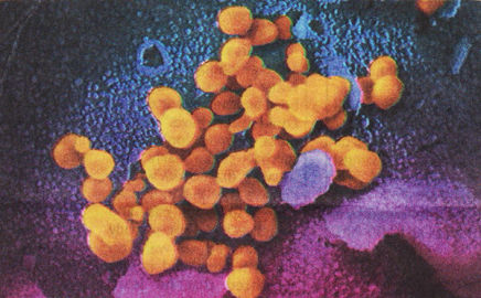 coronavirus US National Institutes of Health